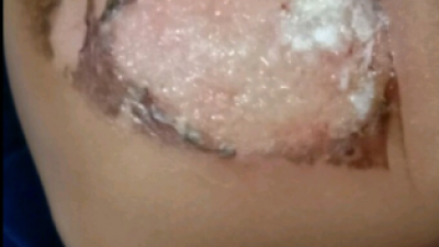 Kekerasan Terhadap Anak Oleh Ibu Kandung Guncang Pangkalpinang, Korban Dievakuasi Ke Rumah Sakit